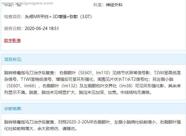 脑部核磁报告